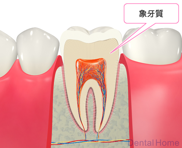 象牙質