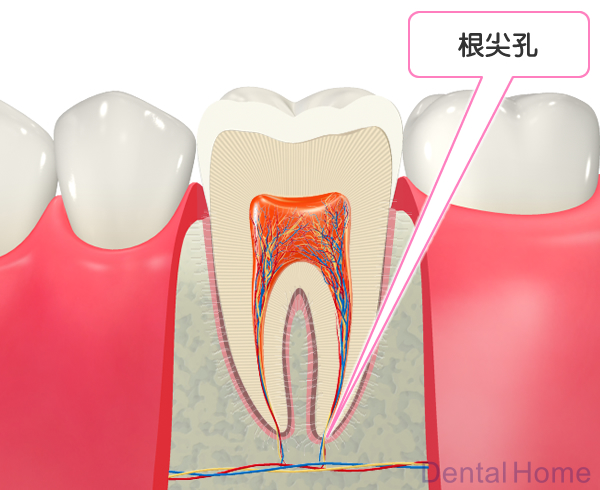 根尖孔