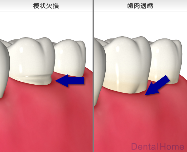 薬物による影響